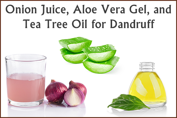 onion juice, aloe vera gel, and tea tree oil for dandruff control