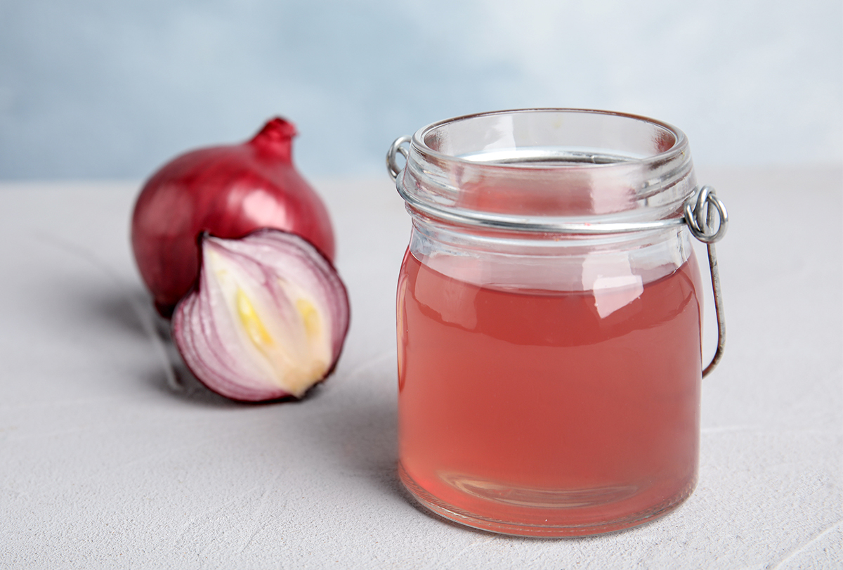 onion juice for dandruff