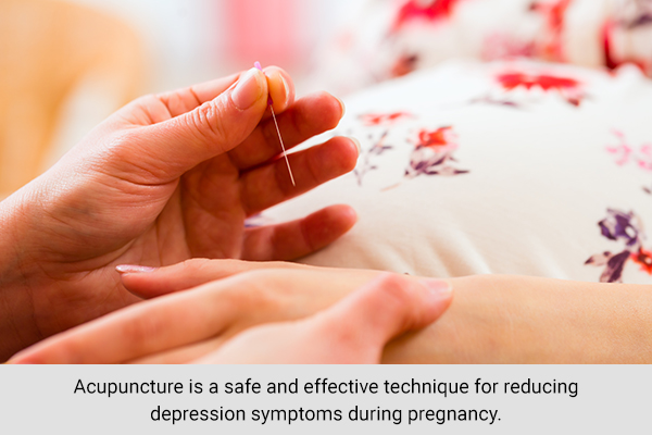 try acupuncture therapy for reducing depressive symptoms during pregnancy